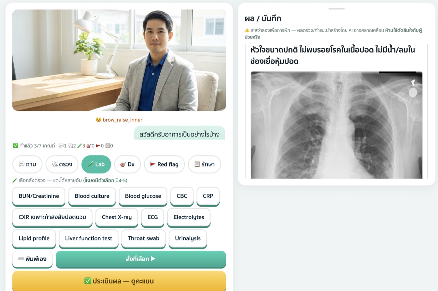 หน้าจอสถานี Embla: ผู้ป่วยจำลอง สั่งตรวจ Lab และอ่านภาพเอกซเรย์ทรวงอกจริง
